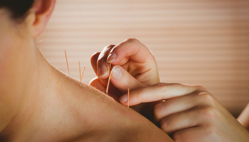A acupuntura e o período de tratamento